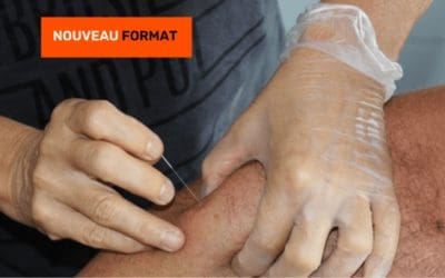 le dry needling, la formation d'SSK pour les kinés