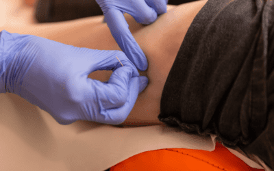 formaiton kiné dry needling