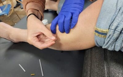 pratique du dry needling chez ssk formation avec pierre meurisse