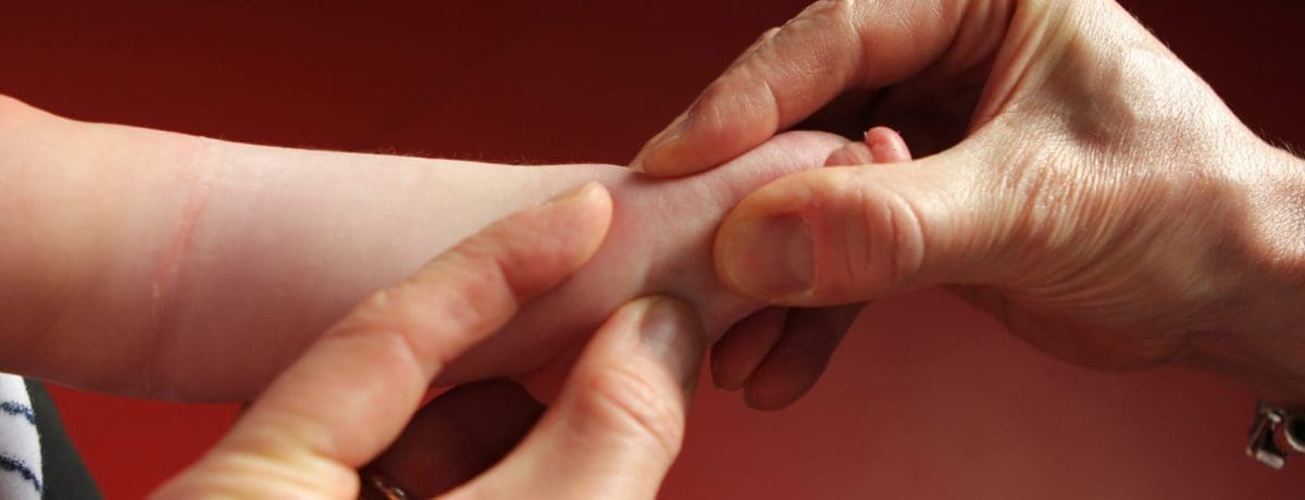 Rééducation du pied du nourrisson – De la simple malposition au Pied Bot Varus Equin (10-12 Février 2027 ) Lyon