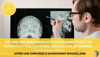 volume des sinus nasaux et maxillaires chez les patients souffrant d'apnée obstructive du sommail apres une chirurgie davancement bimaxillaire volume des sinus nasaux et maxillaires chez les patients souffrant d'apnée obstructive du sommail apres une chirurgie davancement bimaxillaire