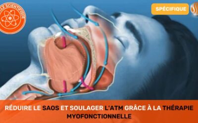 Réduire le SAOS et Soulager l'ATM grâce à la Thérapie Myofonctionnelle