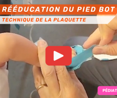 Extrait vidéo Formation Rééducation du Pied Bot Correction avec la technique de la plaquette
