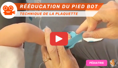 Extrait vidéo Formation Rééducation du Pied Bot Correction avec la technique de la plaquette