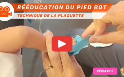 Extrait vidéo Formation Rééducation du Pied Bot Correction avec la technique de la plaquette